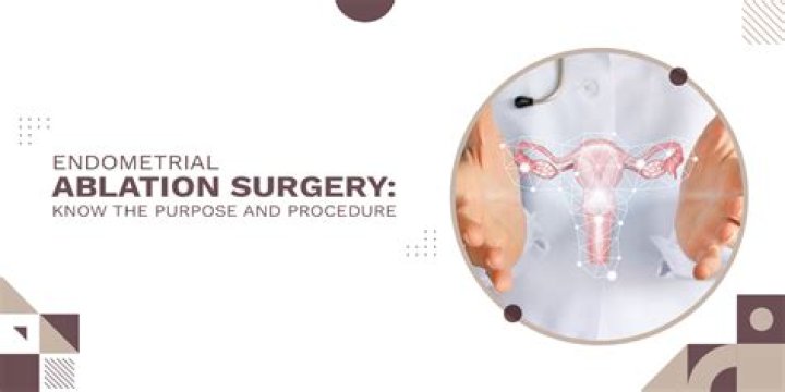 Who qualifies for endometrial ablation?