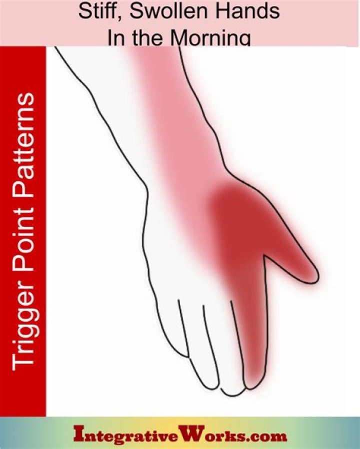 Why are my hands stiff in the morning?