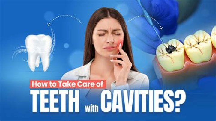 Why do I have so many cavities but take care of my teeth?