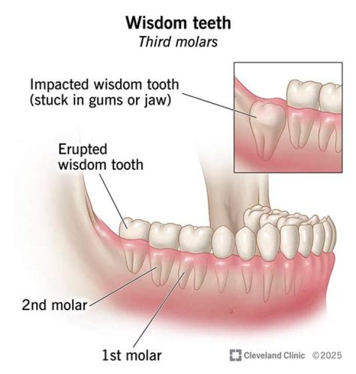 Why do we have wisdom teeth?