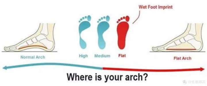 Why does flat feet disqualify you from the military?