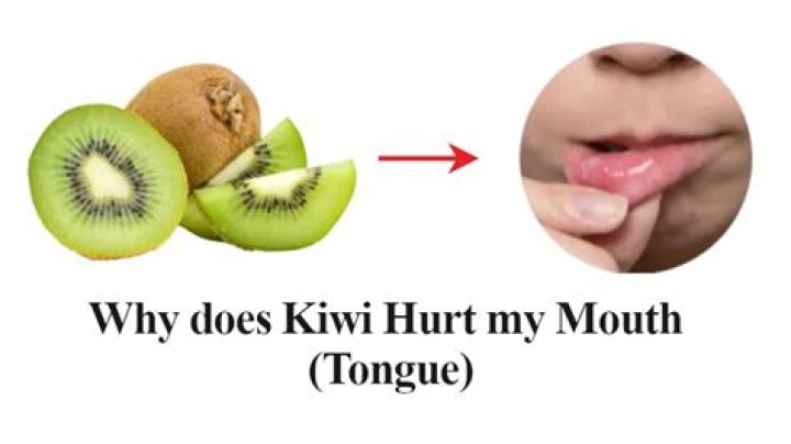 Why does kiwi burn my tongue?