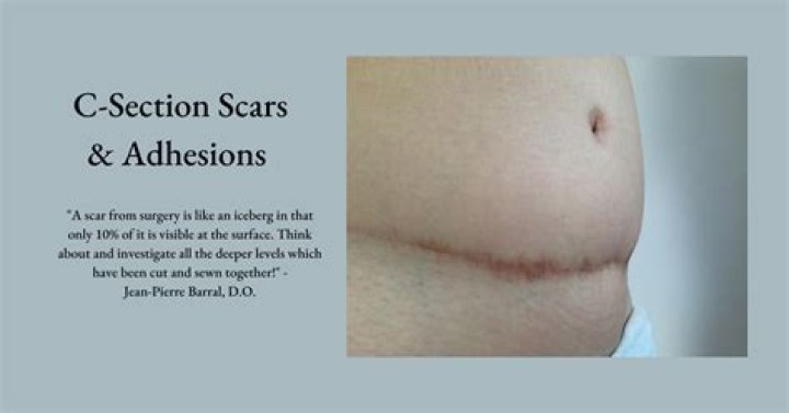 Why does my C-section scar hurt inside?