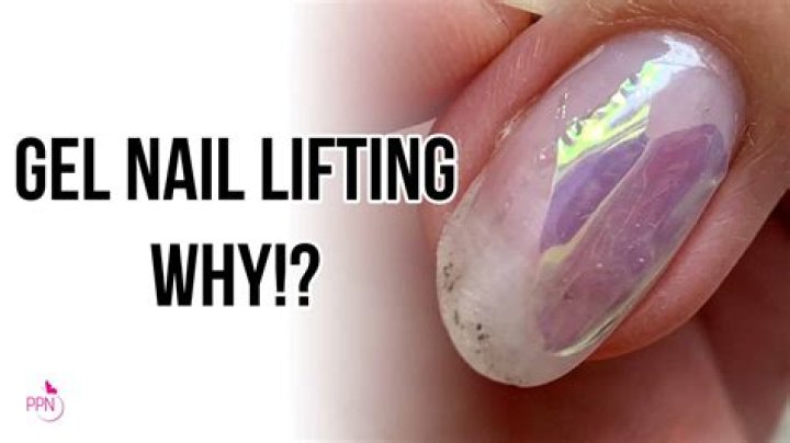 Why does my gel keep lifting?