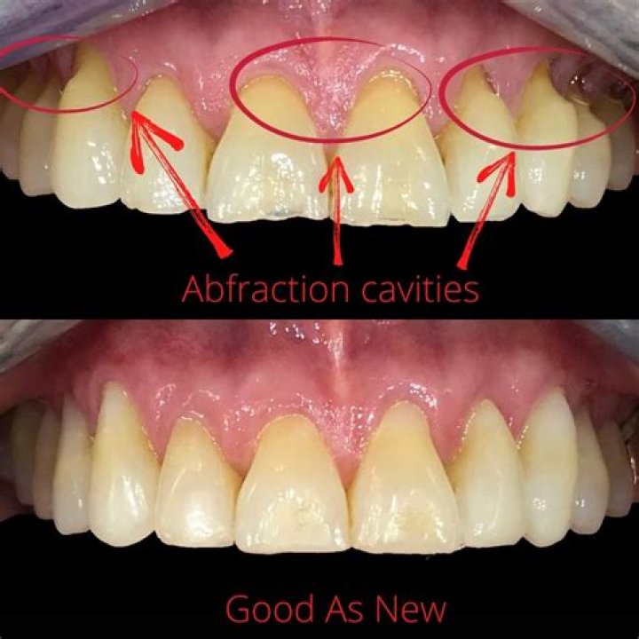 Why does my tooth feel like it has a heartbeat?