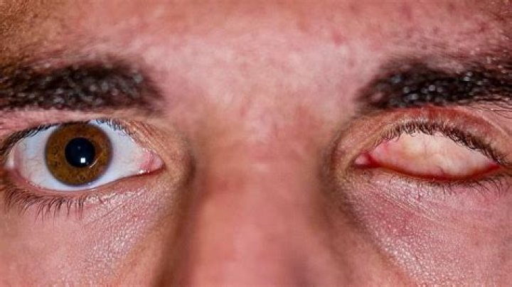 Why is Magnus missing an eye?