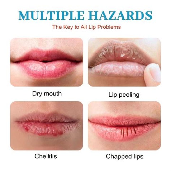 Why you should not lick your lips?