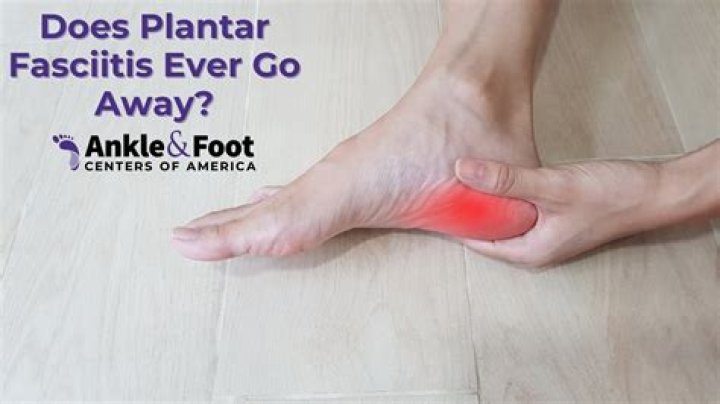 Will plantar fasciitis go away if I keep running?